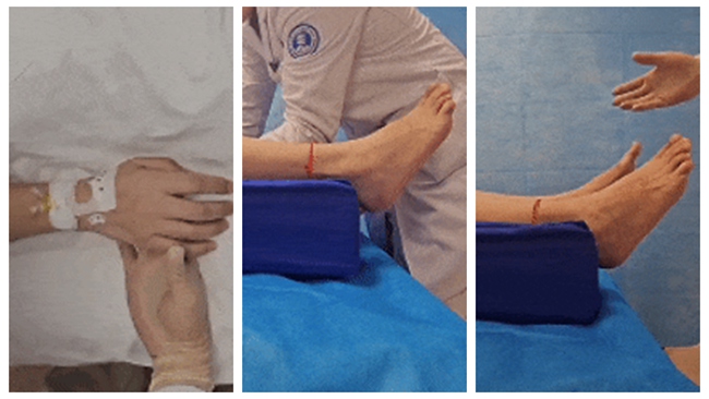 電刺激6小時后患者恢復情況。